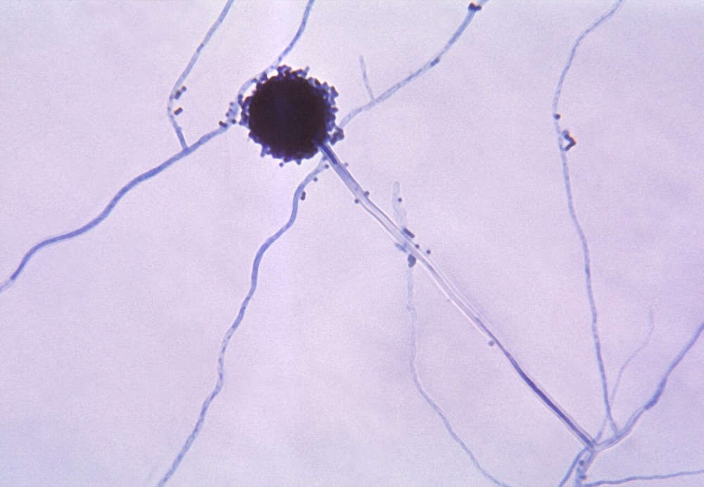 Kolonie von Aspergillus niger mit heller Basis und dichten schwarzen Sporenköpfen