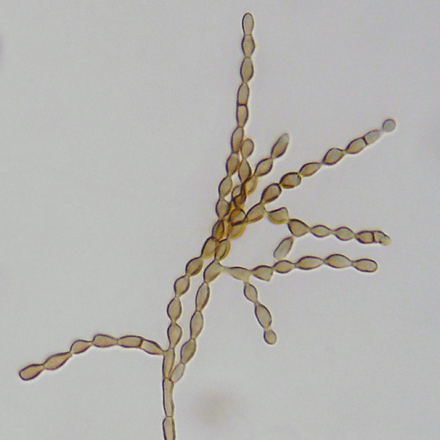 Une colonie de Cladosporium cladosporioides, l’une des moisissures courantes dans les joints de lave-linge