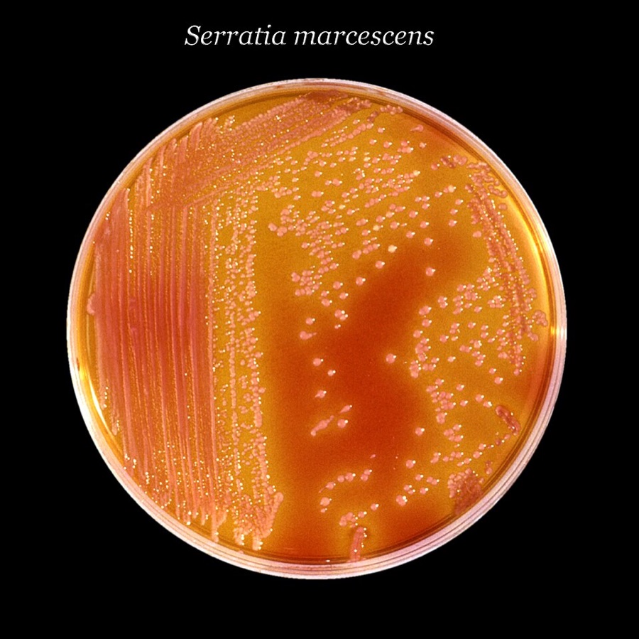 Des bactéries Serratia marcescens cultivées sur une boîte de Petri, avec leur pigment rouge-rose caractéristique
